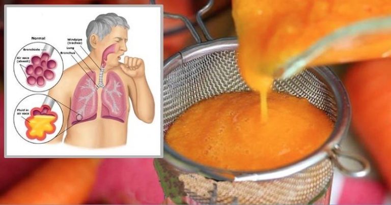 2-Ingredient Homemade Syrup For Stopping Cough And Clearing Phlegm From